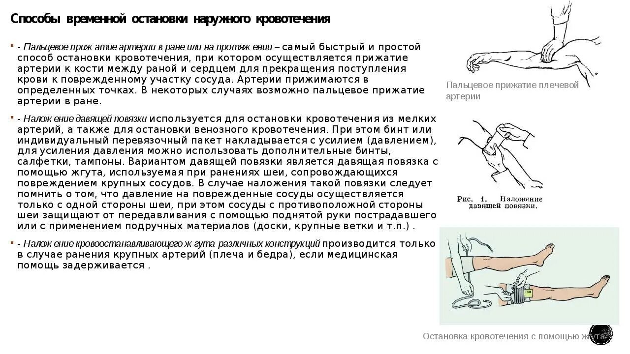 Первая помощь при наружных кровотечениях тест. Временная остановка венозного кровотечения. Порядок остановки венозного кровотечения. Венозное кровотечение первая помощь алгоритм. Венозное кровотечение останавливают.