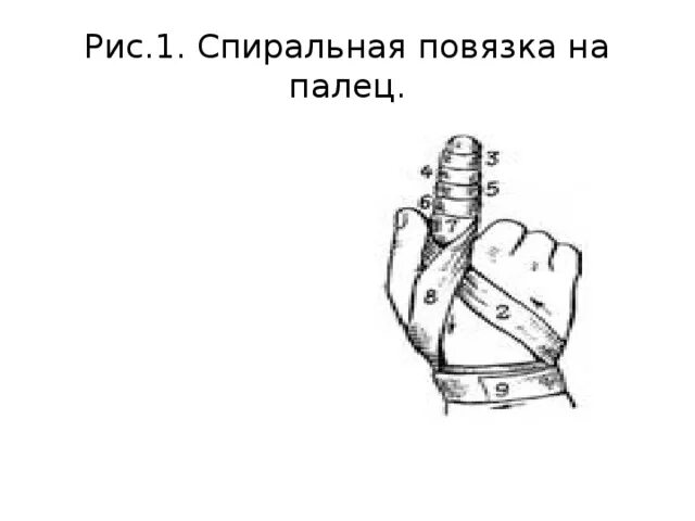 Спиральная повязка алгоритм. Спиральная повязка на указательный палец. Спиральная повязка на один палец кисти. Наложение спиральной повязки на палец. Спиральная повязка на 2 палец правой кисти.