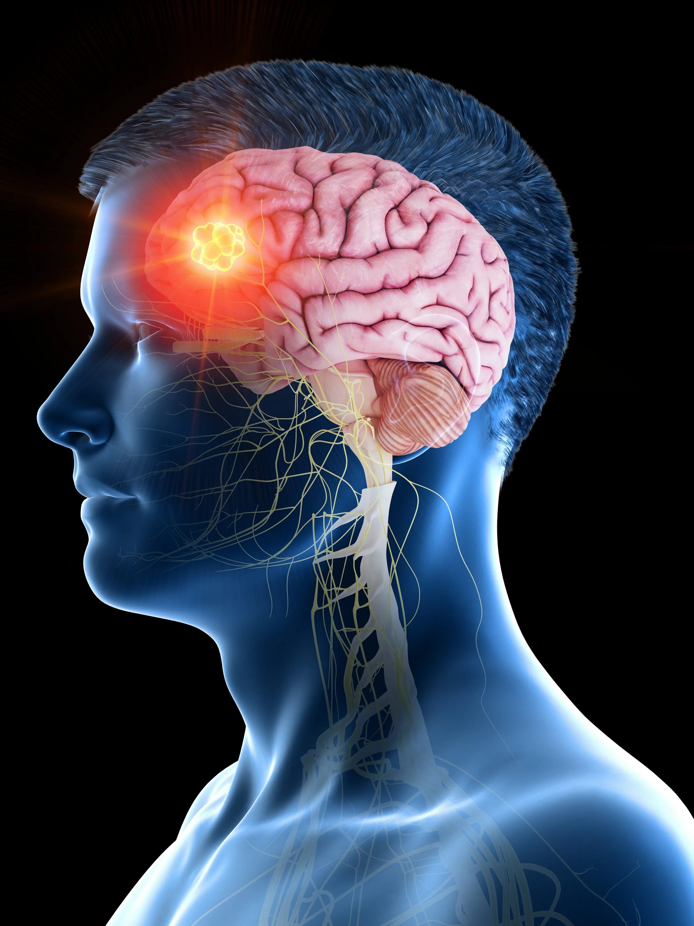 Brain 51