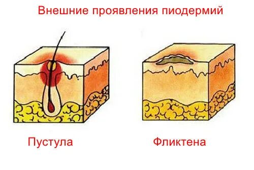 Папула вторичные элементы