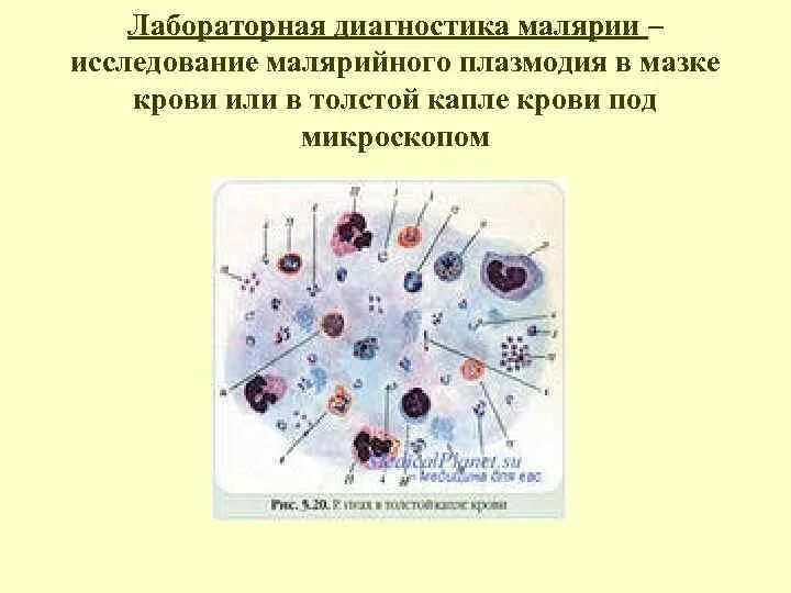 Несколько ведущих генераций плазмодиев возможно при