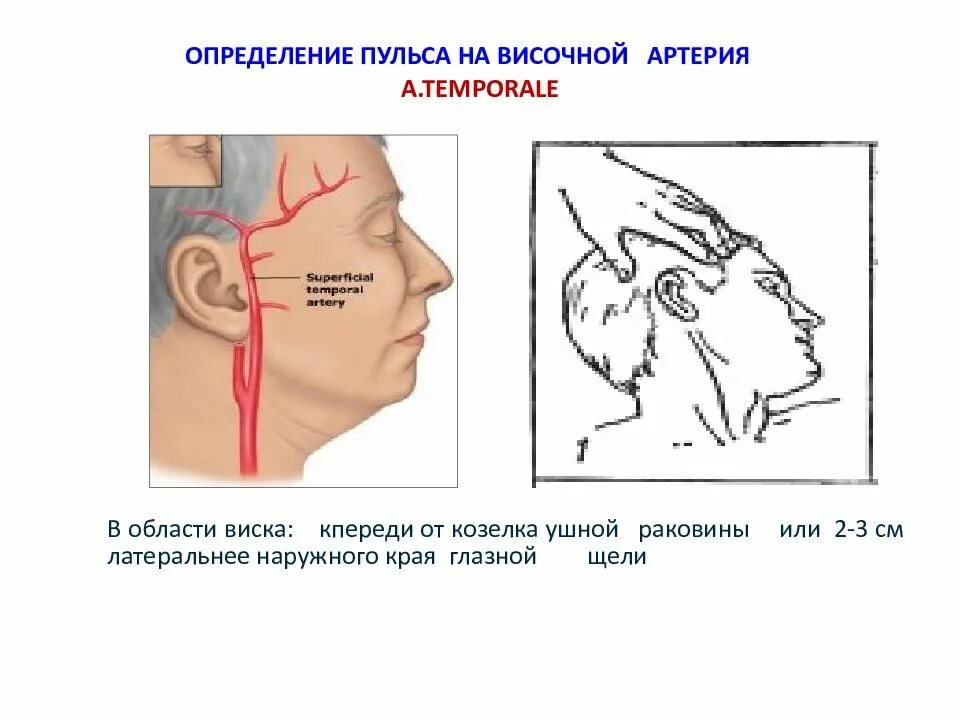 Измерение пульса на височной артерии. Пульс на височной артерии. Пальпация височной артерии. Исследование пульса на голове. Сонная артерия как нащупать где