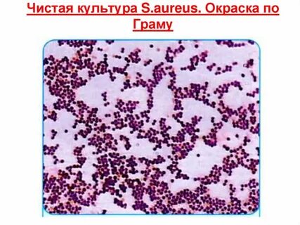 Грам кокки