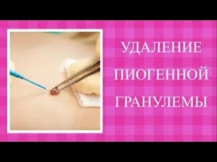 14 удалить
