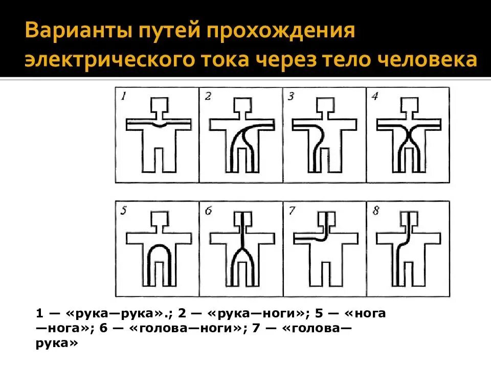 Варианты поражения электрическим током. Схемы прохождения тока через организм человека. Схемы прохождения электрического тока через тело человека. Схемы поражения человека электрическим током. Опасные схемы прохождения электрического тока.