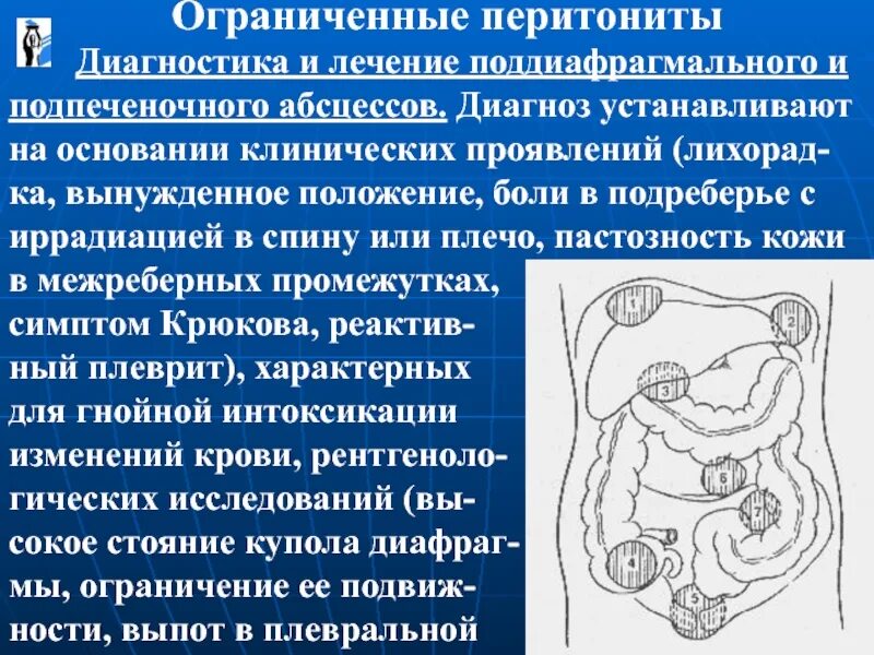 Подпеченочный абсцесс. Поддиафрагмальный абсцесс. Классификация поддиафрагмального абсцесса. Абсцессы подпеченочные поддиафрагмальные. Дренирование поддиафрагмального абсцесса.