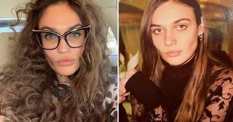 Водонаева до и после пластики