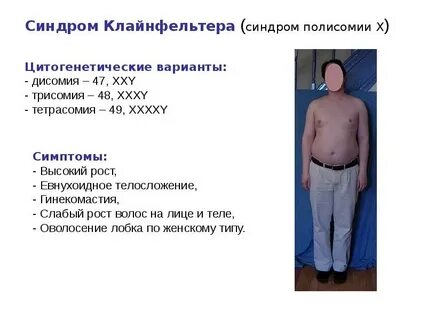 Наличие лишней х хромосомы у мужчин