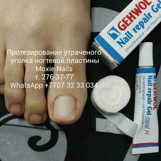 Паста от онихолизиса ногтей