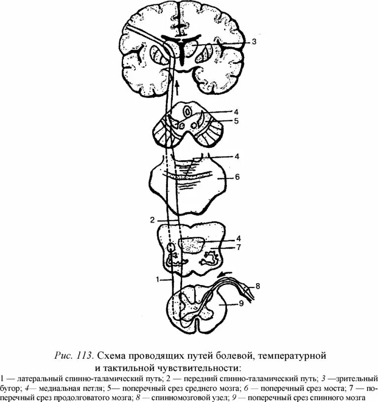Спинно таламический путь. Проводящие пути болевой и температурной чувствительности схема. Схема проводящего пути температурной и болевой чувствительности. Проводящие пути тактильной чувствительности схема. Болевая температурная и тактильная чувствительность проводящие пути.