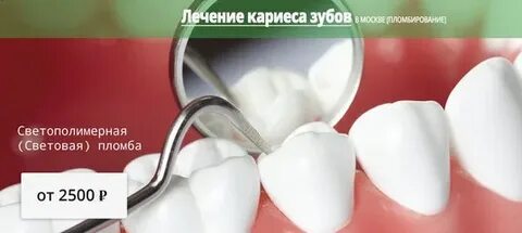 Сколько в среднем стоят пломбы