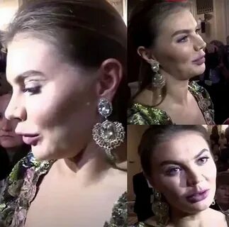 Кабаева после пластики