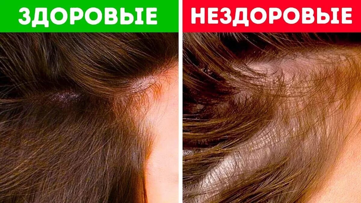 Сколько в норме выпадает