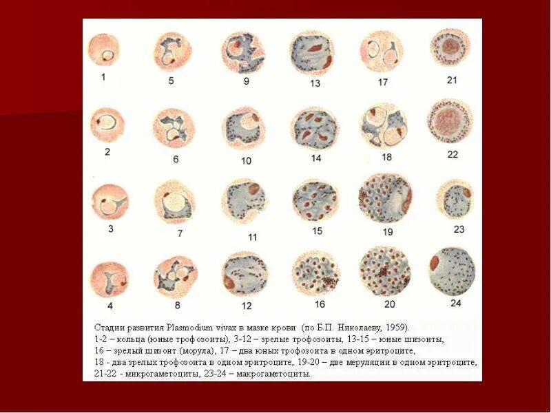 Plasmodium Vivax на стадии кольца. Малярийный плазмодий (Plasmodium Vivax) – шизонт в стадии кольца. Falciparum плазмодий шизонт в стадии кольца. Plasmodium Vivax форма. Шизонт это