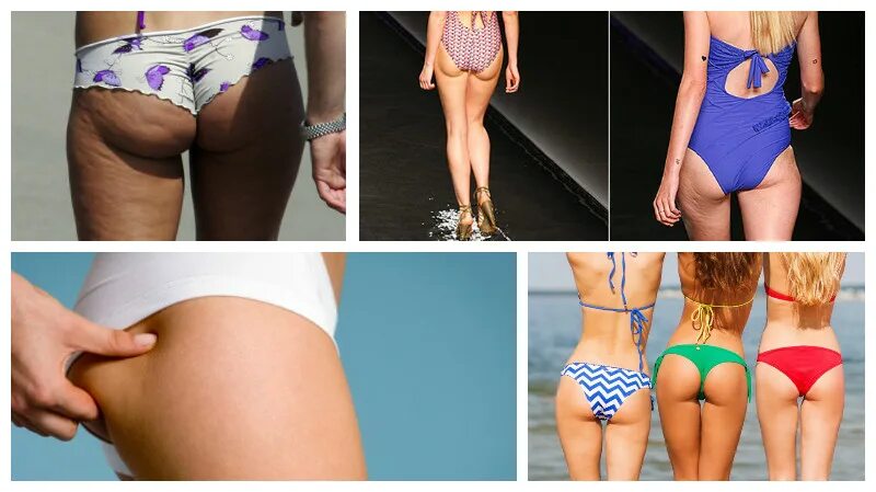 Скарлетт йоханссон худая. Синди кроуфорд целлюлит. Обвисшие ягодицы. Стройные бедра. Шорты на целлюлитных ногах.