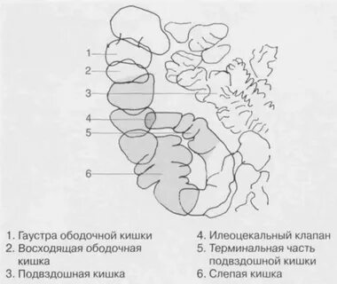 Гаустры