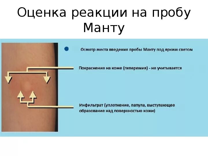 Что нельзя есть при диаскинтесте. Что нельзя есть при диаскинтесте