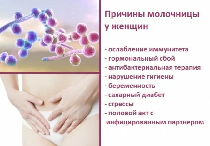 Почему у женщины появляется. Почему у женщины появляется. Причины цистита у женщин. Молочница причины появления у женщин. Факторы риска цистита.