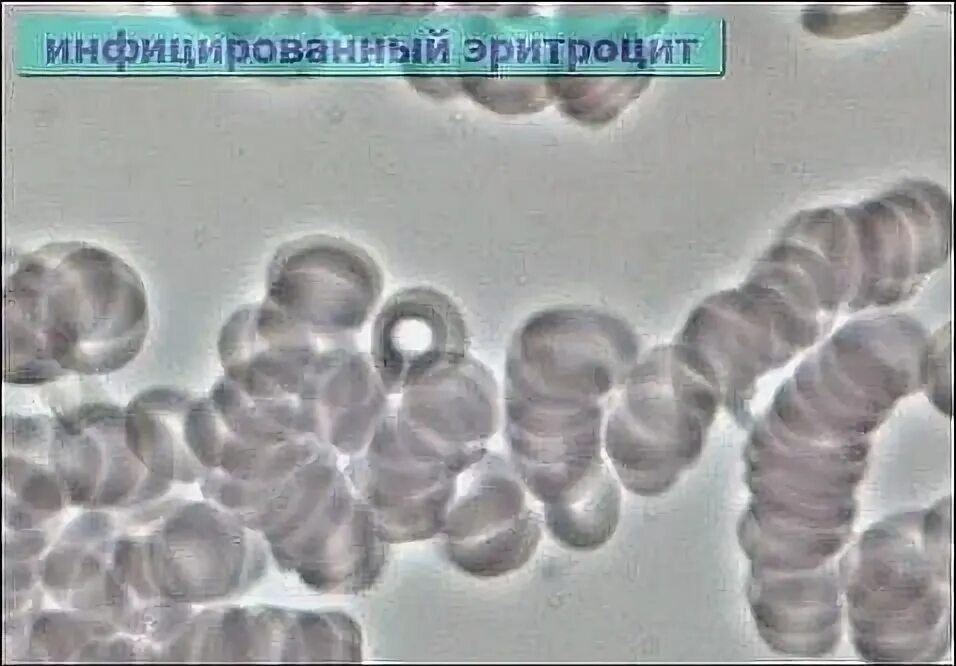 Почему вирусы не инфицируют эритроциты