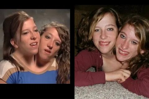 Abby and brittany hensel tlc - yesdarelo.