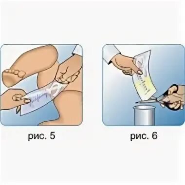 Как правильно приклеить мочеприемник девочке 1. Мочеприемник у новорожденных девочек для сбора. Как правильно прикрепить мочеприемник девочке. Как правильно прикрепить мочеприемник девочке. Мочеприемник для новорожденных мальчиков.