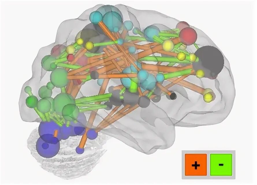 Brain 48. Brain Connectivity.