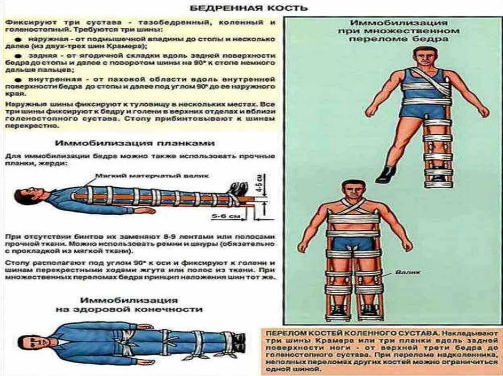 Помощь при открытом переломе бедра. Оказание первой помощи переломы бедренной кости. Оказание помощи при переломе бедренной кости. Оказание помощи при переломах. Оказание первой помощи при закрытом переломе бедра.