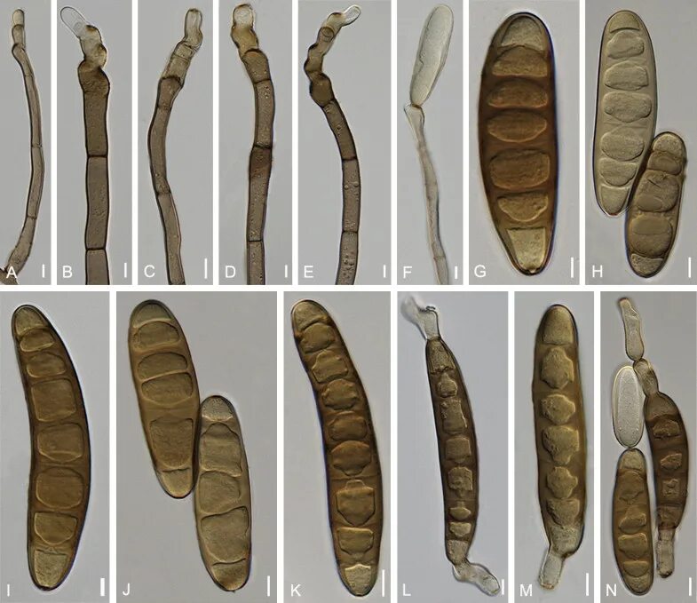 Cochliobolus sativus конидии. Bipolaris victoriae s27. Bipolaris spores. Гельминтоспориоз пшеницы конидии. Споры bipolaris sorokiniana.