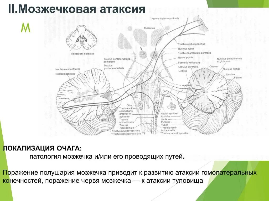 Тест мозжечок. Мозжечковая атаксия локализация поражения. Мозжечковая атаксия у лошадей. Атаксия при поражении полушарий мозжечка. Атаксия червя мозжечка.