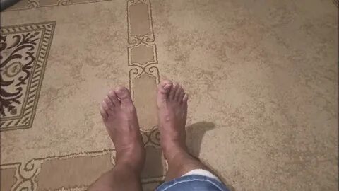 Реабилитация трехлодыжечного перелома