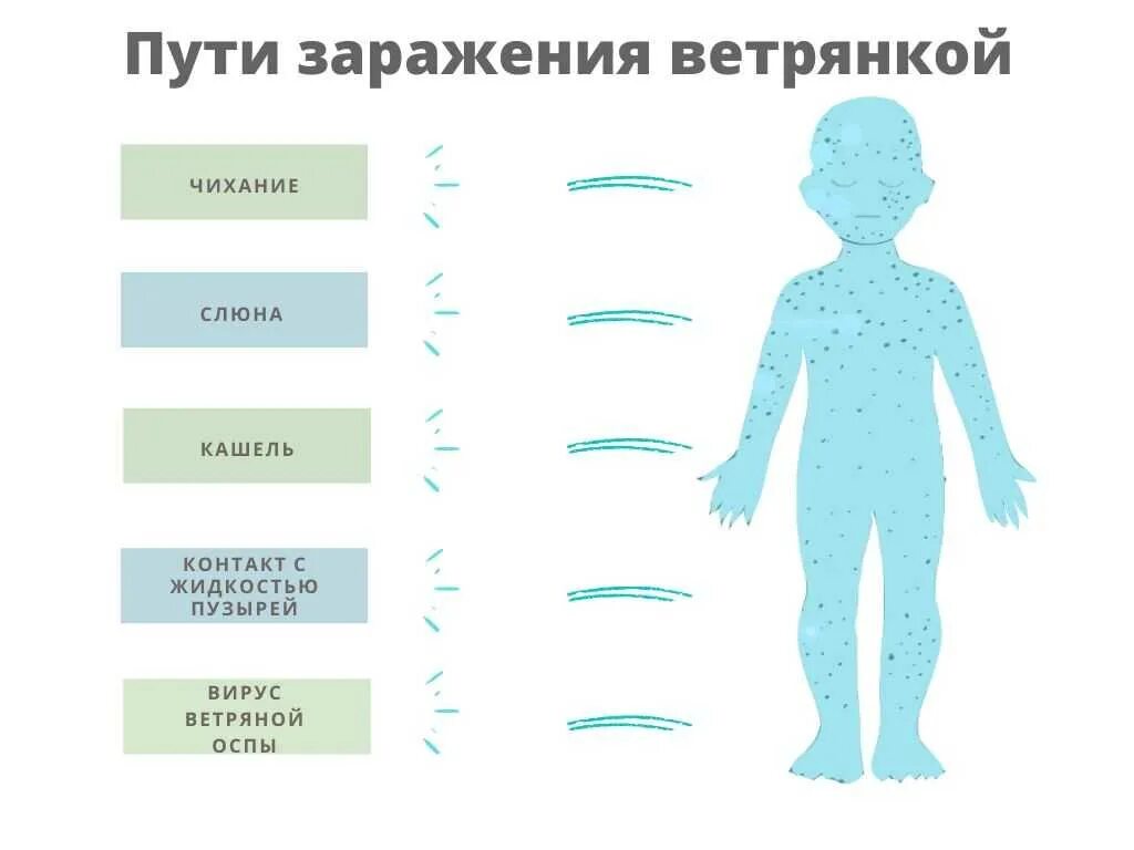 Сколько дней держится корь. Ветряная оспа пути заражения. Еак передаётся ветрянка. Как передаётся ыетпянка. Симптомы при ветрянке у детей.