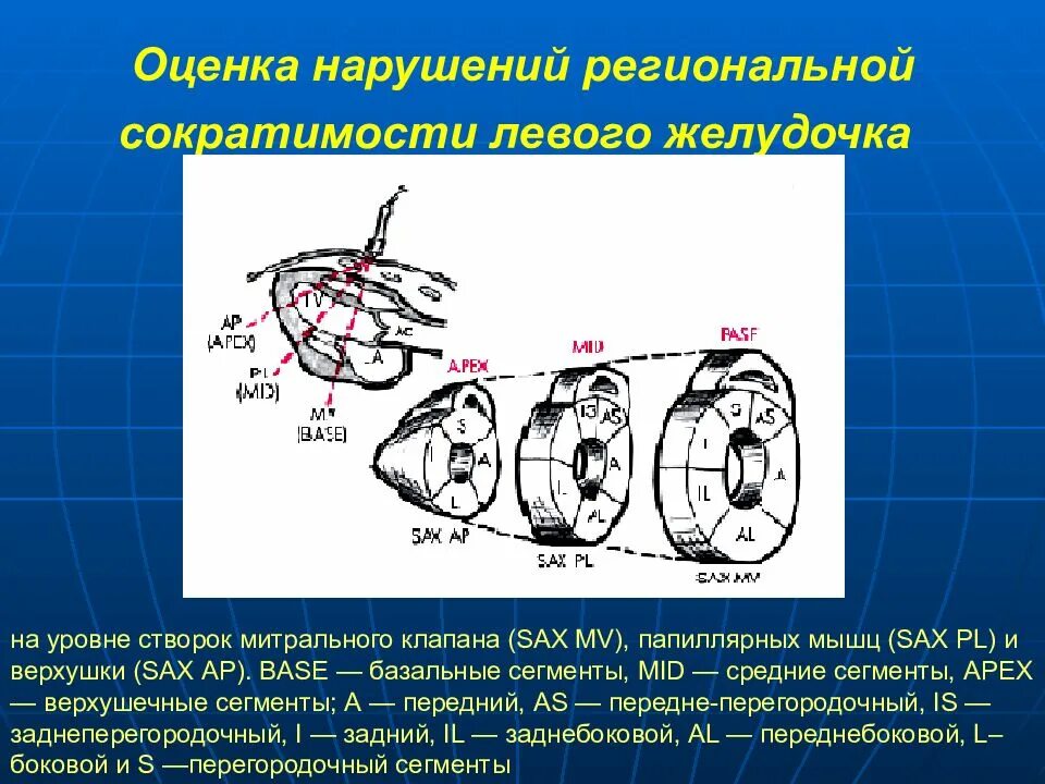 Глобальная сократимость левого. Нарушение локальной сократимости миокарда левого желудочка. Локальная сократимость миокарда левого желудочка норма. Сократительная способность миокарда левого желудочка норма. Оценка локальной сократимости миокарда левого желудочка.