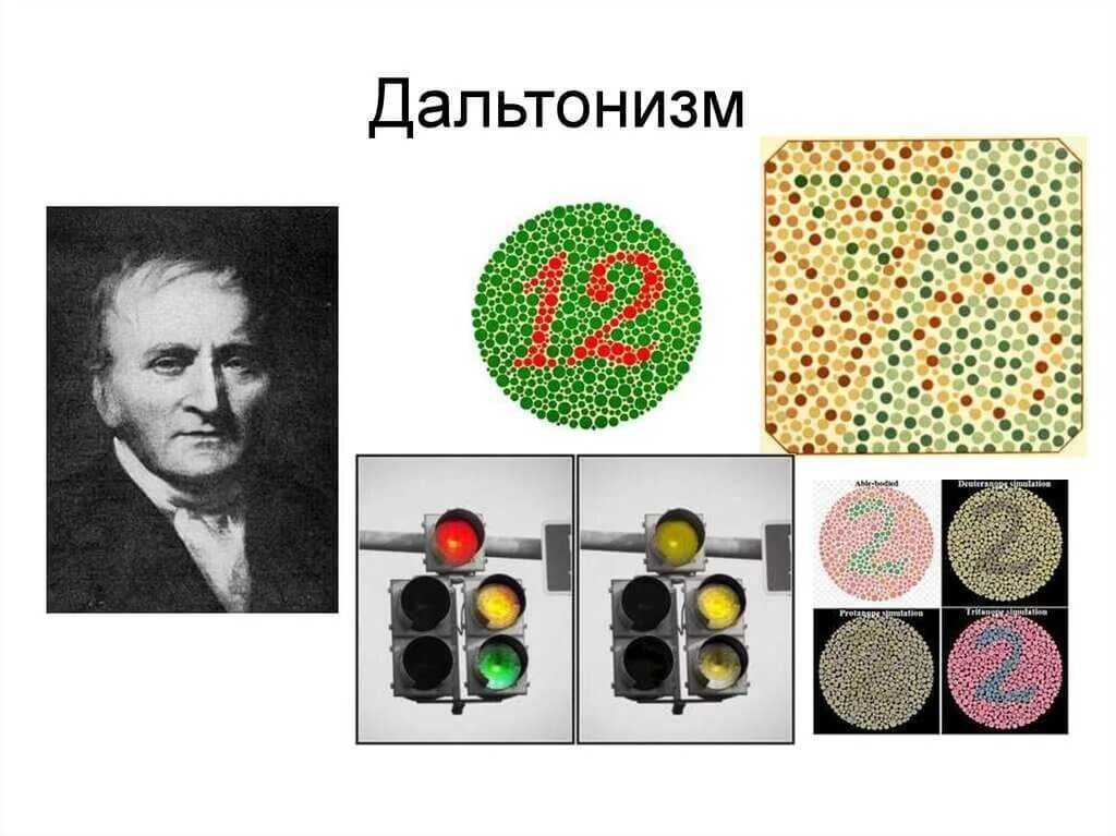 Дальтонизм цветовая слепота. Дихромат дальтонизм. Дальтонизм. Генные заболевания дальтонизм. Дальтонизм.