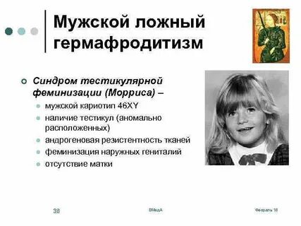 Синдром морриса у женщин