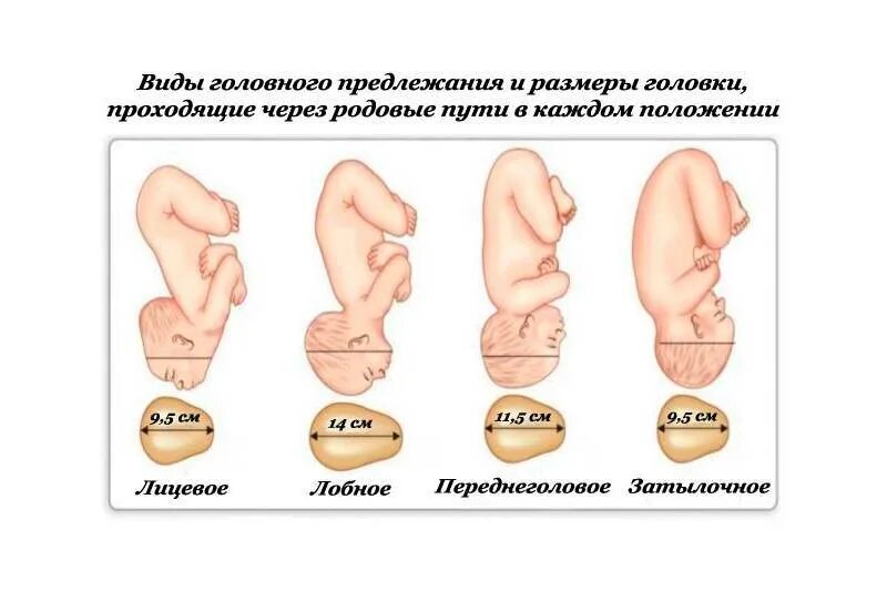 Положение плода продольное предлежание головное. Положение плода продольное головное 2 позиция передний вид. Головное предлежание плода на 32 неделе беременности. Продольное расположение плода при беременности 30 недель. Ребенок расположен справа