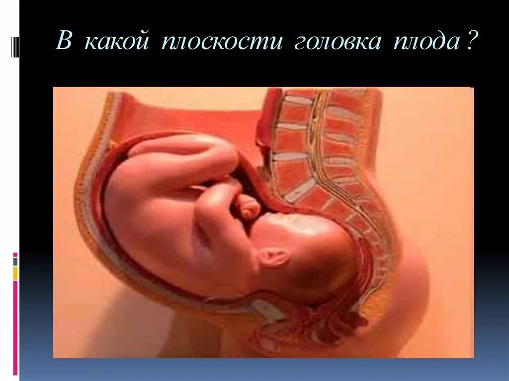 Расположение ребенка на 32 неделе. Низко расположена головка плода на 32 неделе беременности. Низкое расположение ребенка. Расположение ребенка на 33 неделе.