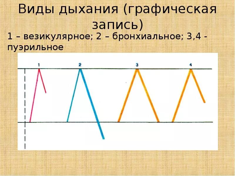 Дыхание у детей пуэрильное до какого возраста. Везикулярное и бронхиальное дыхание. Типы дыхания везикулярное. Пуэрильное дыхание схема. Везикулярное пуэрильное бронхиальное.