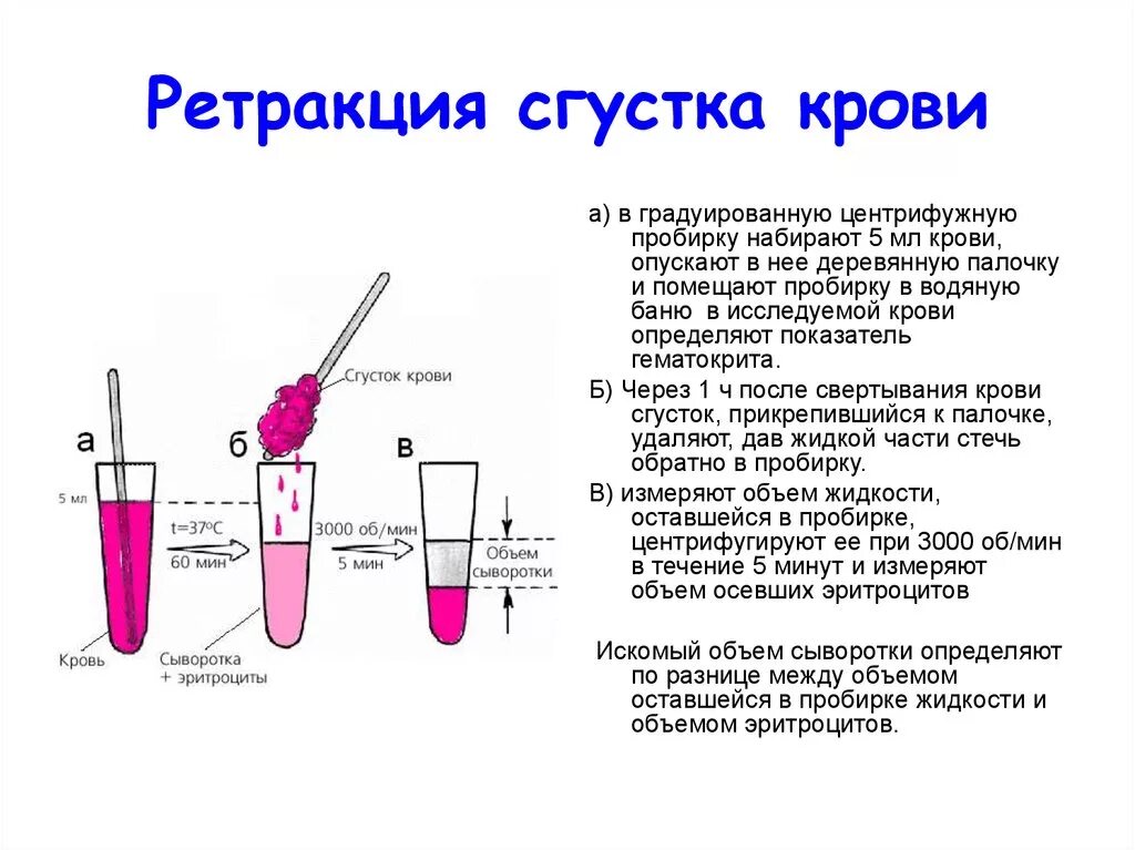 Почему сворачивается кровь из вены. Ретракция кровяного сгустка анализ. Ретракция кровяного сгустка схема. Ретракция кровяного сгустка исследование. Степень ретракции кровяного сгустка.