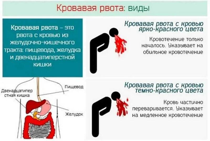 Сморкаюсь с кровью почему