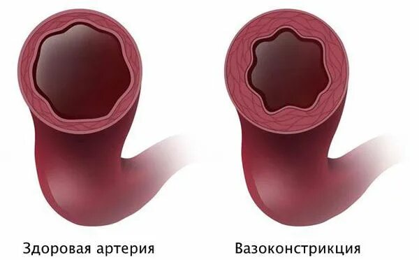 Вазоконстрикция. Артериальная вазоконстрикция. Периферическая вазоконстрикция. Патологическая вазоконстрикция это. Расширение сужение кровеносных сосудов кожи