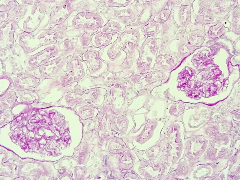 Соединительнотканная капсула почки. Ткани почек. Паренхима почки состоит из. Составные части почки. Почка окраска гематоксилин-эозином.