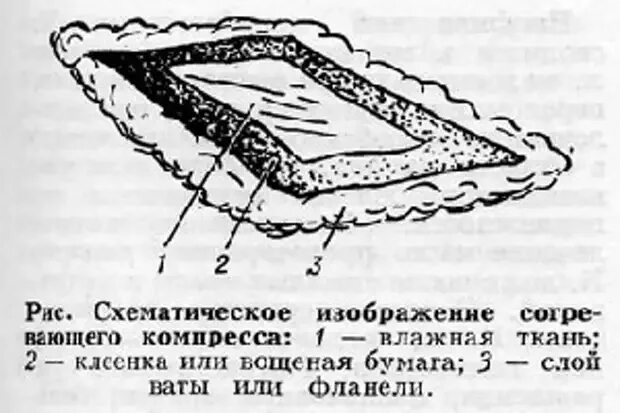 Согревающий полуспиртовой компресс слои. Постановка согревающего компресса слои. Водно-спиртовой согревающий компресс накладывают на:. Слои компресса спиртового.