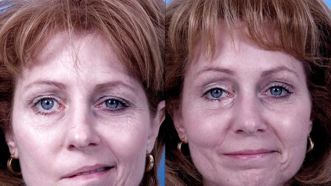 Нервный срыв симптомы. Признаки нервного срыва. Нервный срыв симптомы. Нервный срыв симптомы у подростков. Признаки нервного расстройства.