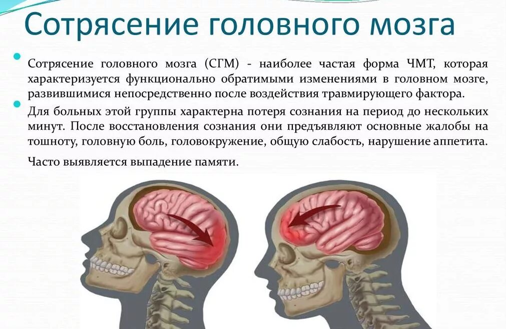 Три основных признака при сотрясении головного мозга.. Симптомом сотрясения головного мозга является. Основной симптом тяжелого сотрясения головного мозга. Симптоматика сотрясения головного мозга обуславливается.