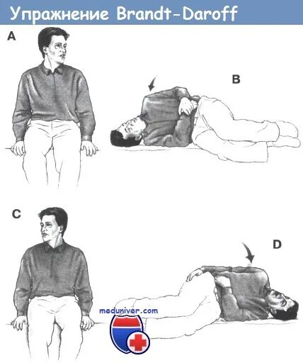 Упражнения брандта при головокружении. Упражнение при ДППГ упражнение Брандт дарофф. Упражнения Brandt Daroff. Позиционное головокружение упражнения. Вестибулярная гимнастика упражнения Брандта Дароффа.