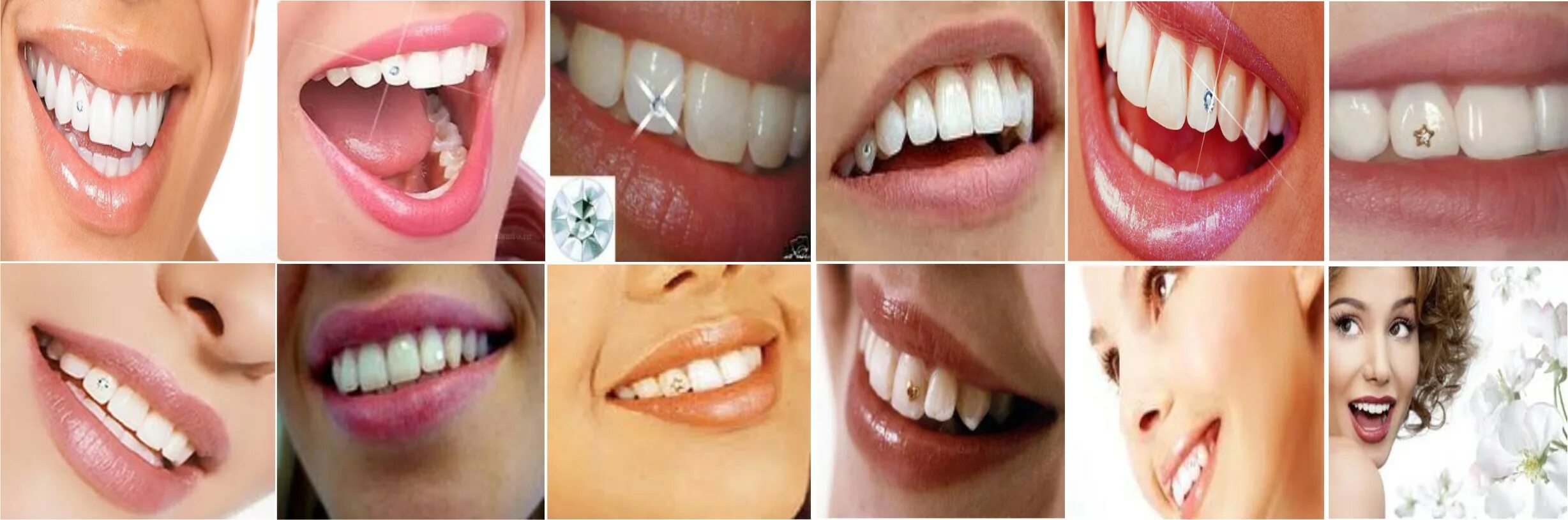 сделать скайсы на зубы