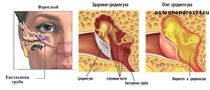 Тубоотит сколько длится