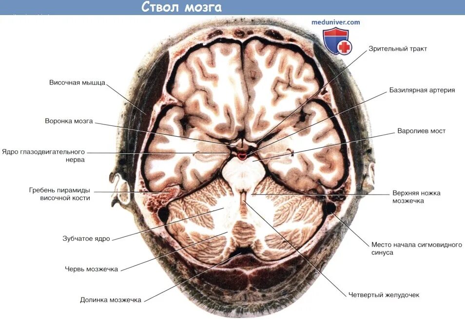 Доли мозга мрт. Желудочки головного мозга кт анатомия. Анатомия и топография ствола мозга. Анатомия головного мозга мрт сагиттальные срезы. Строение ствола мозга кт.