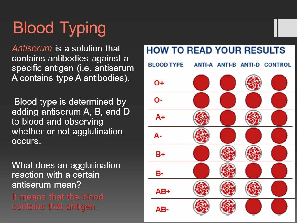 Как по английски кровь. Ab Blood Type. Группы крови на английском. Blood Group Types. Determination of Blood Groups.