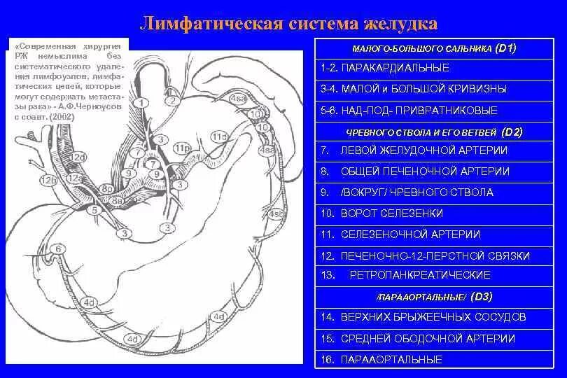 Рак брюшных лимфоузлов. Рак брюшных лимфоузлов